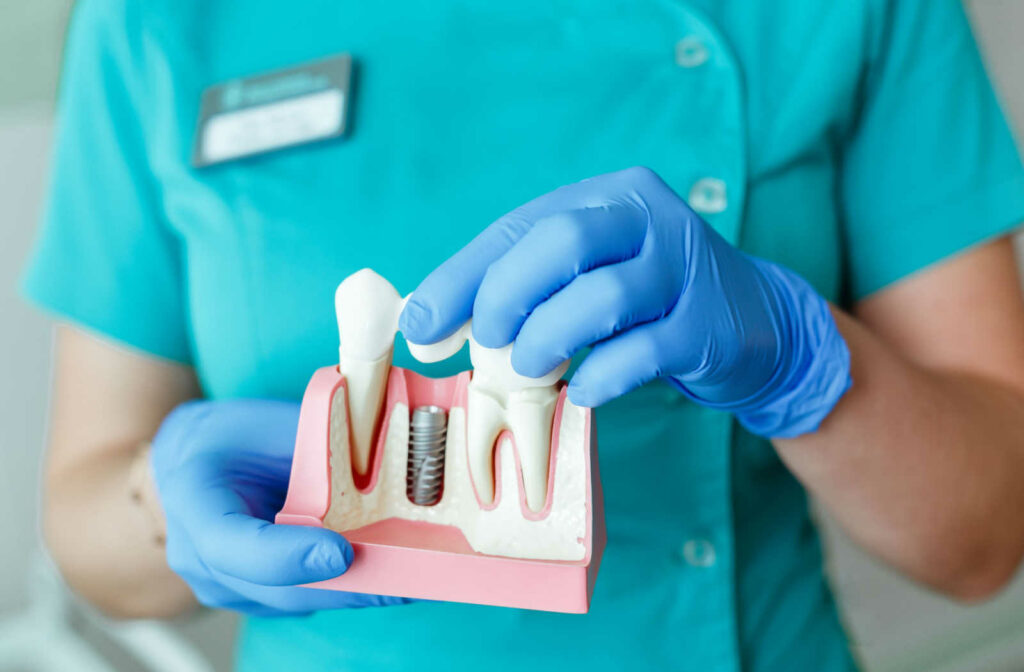 A dentist wearing medical gloves holds a 3D model of a dental implant.