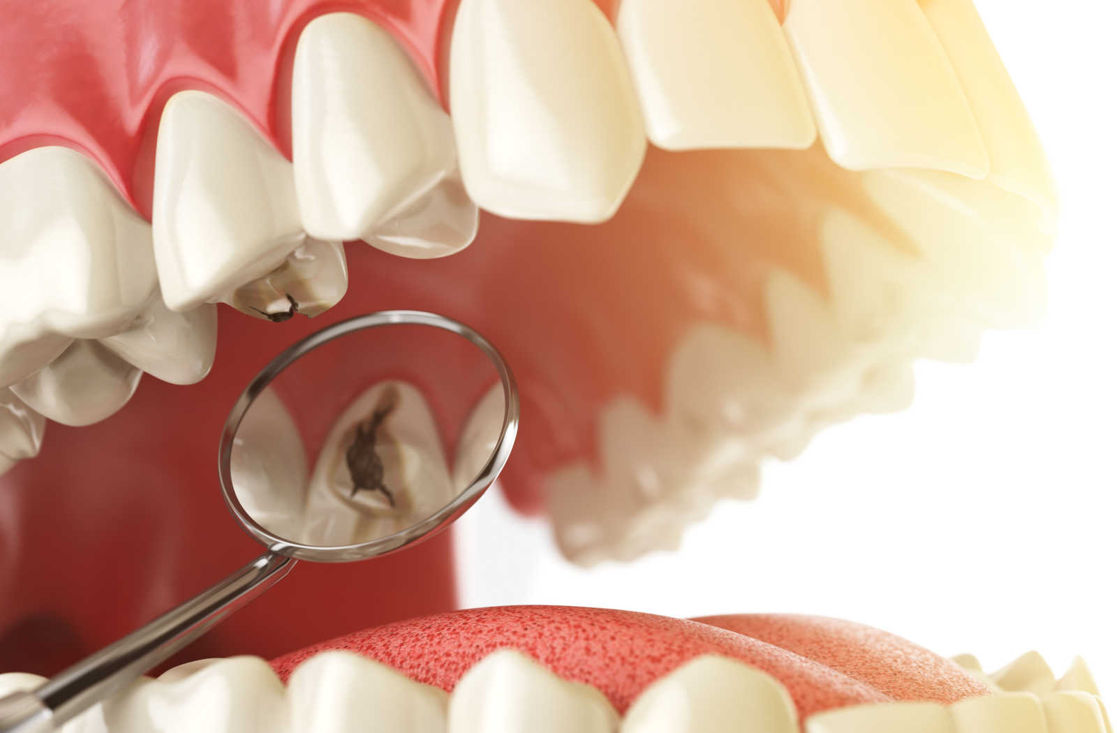 Can Our Teeth Repair Themselves?