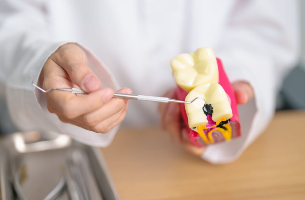 Dentist demonstrating tooth decay on a model using a dental tool.