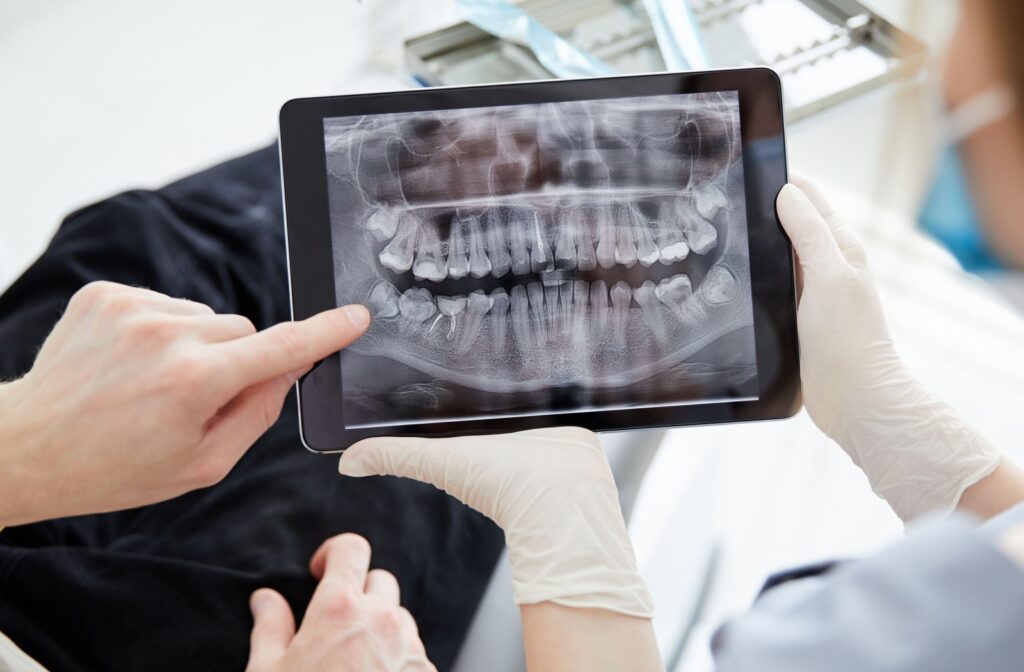 A dentist explains the details of their patient's dental x-rays.