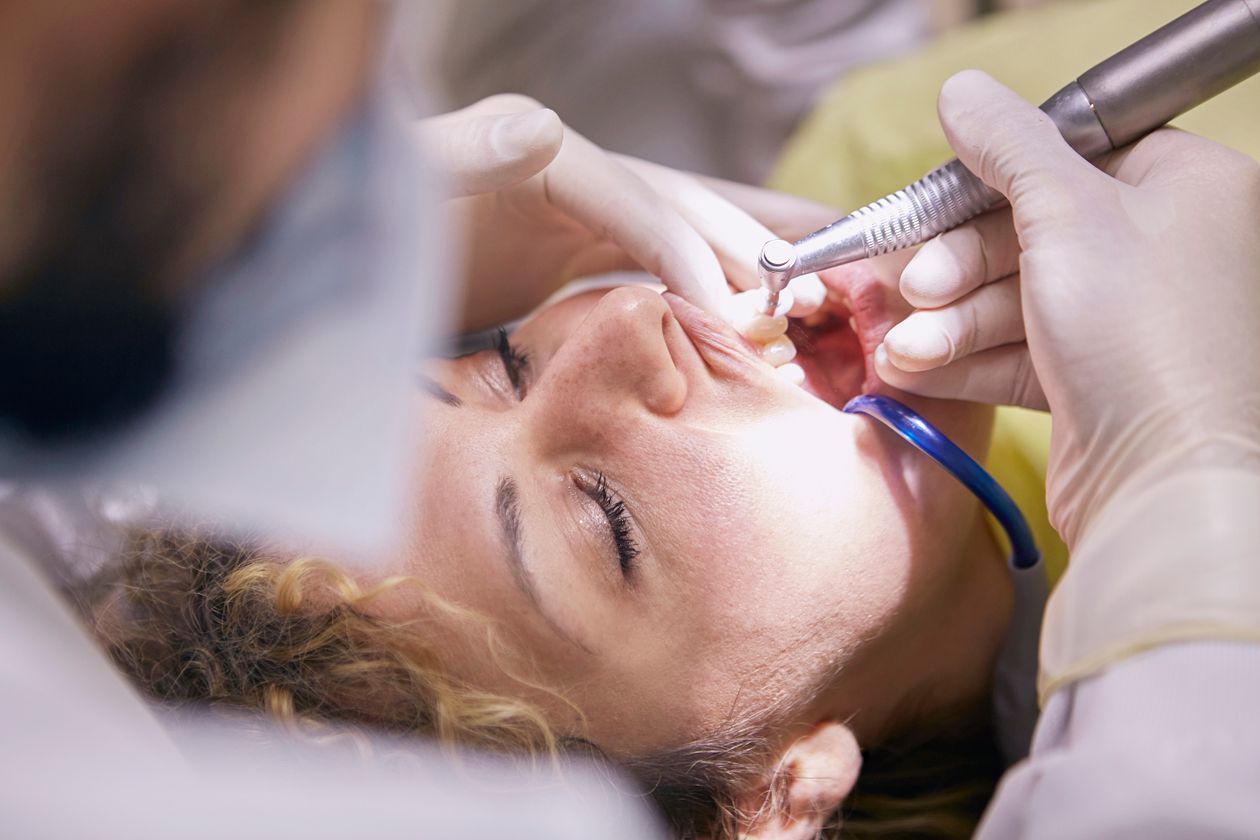 Dental veneers to improve a smile at a dental office in Oakville